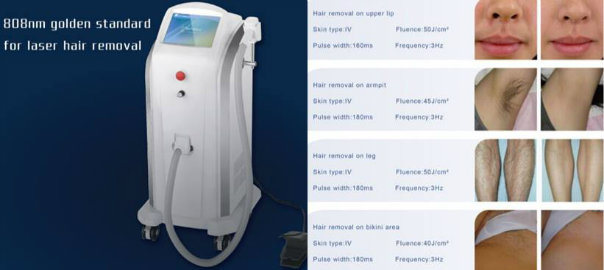 FDA Approved 808nm Diode Laser Lumenis Lightsheer Duet Laser for Sale Soprano Laser Hair Removal Machine