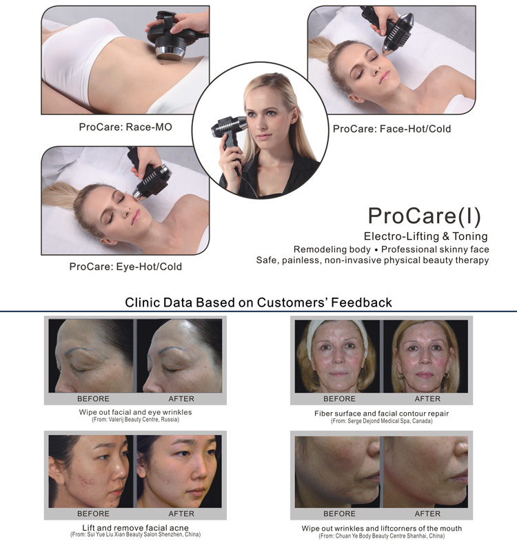 Medical Grade Ultrasound Crymotherapy Skin Rejuvenation Beauty Equipment