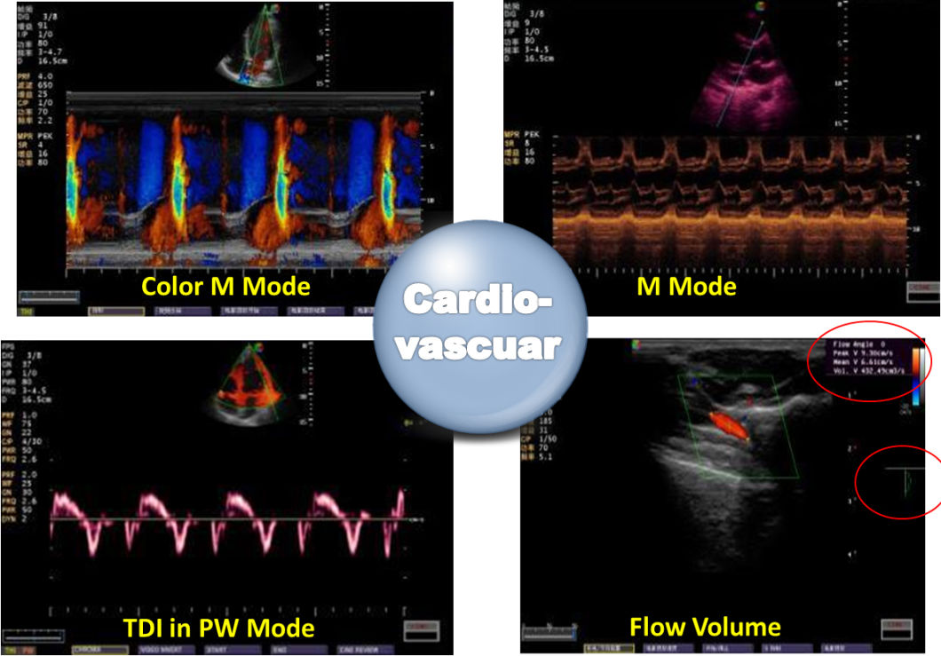 BS-S20 Portable Color Doppler Fetal Ultrasound with High Quality