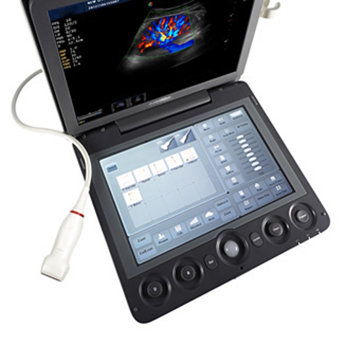 FDA Approved Color Doppler 4D Ultrasound Laptop at Low Cost