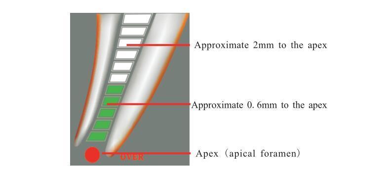 Dental Instrument Endodontic Root Canal Apex Locator Colored Screen Touch