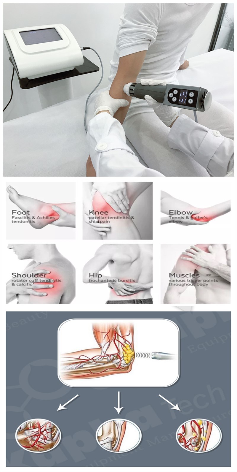 Portable Physical Shockwave Machine Shock Wave Therapy for Bone Healing