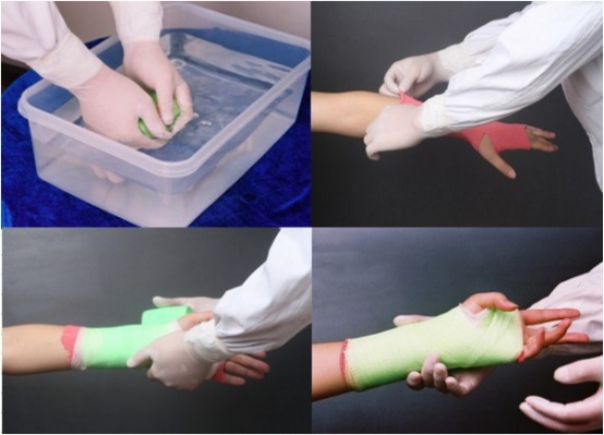 Wrist/Arm/Ankle Fracture Fix Orthopedic Casting Tape, Plaster of Paris Bandage