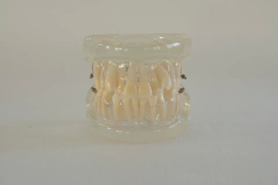Deluxe Dental Orthodontics Typodont Model