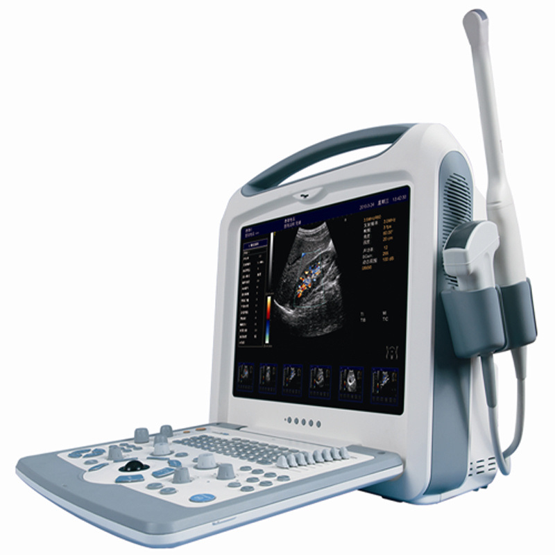 Portable Digital Color Doppler B-Ultrasound Ultrasound Scanner