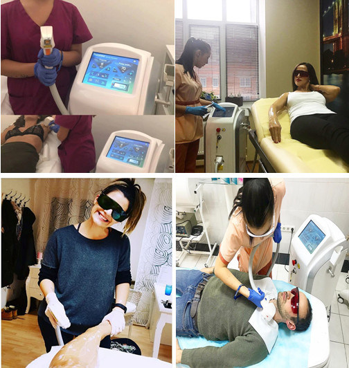 FDA Ce Approved Alma Laser Soprano Ice Diode Laser Hair Removal Machine/Alexandrite Laser Hair Removal