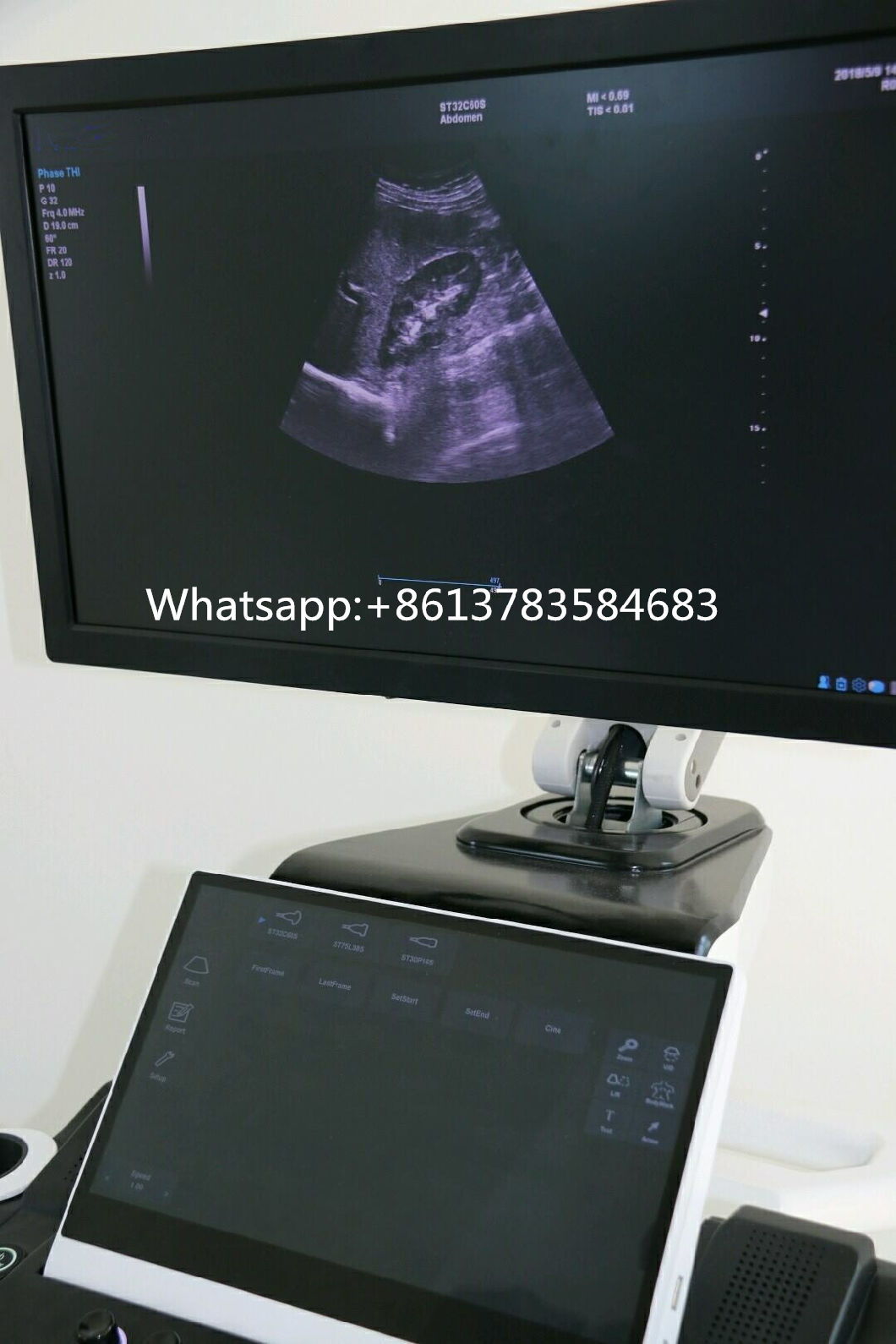 Ce Approved Trolley 4D Color Doppler Ultrasound Scanner for Gynecology