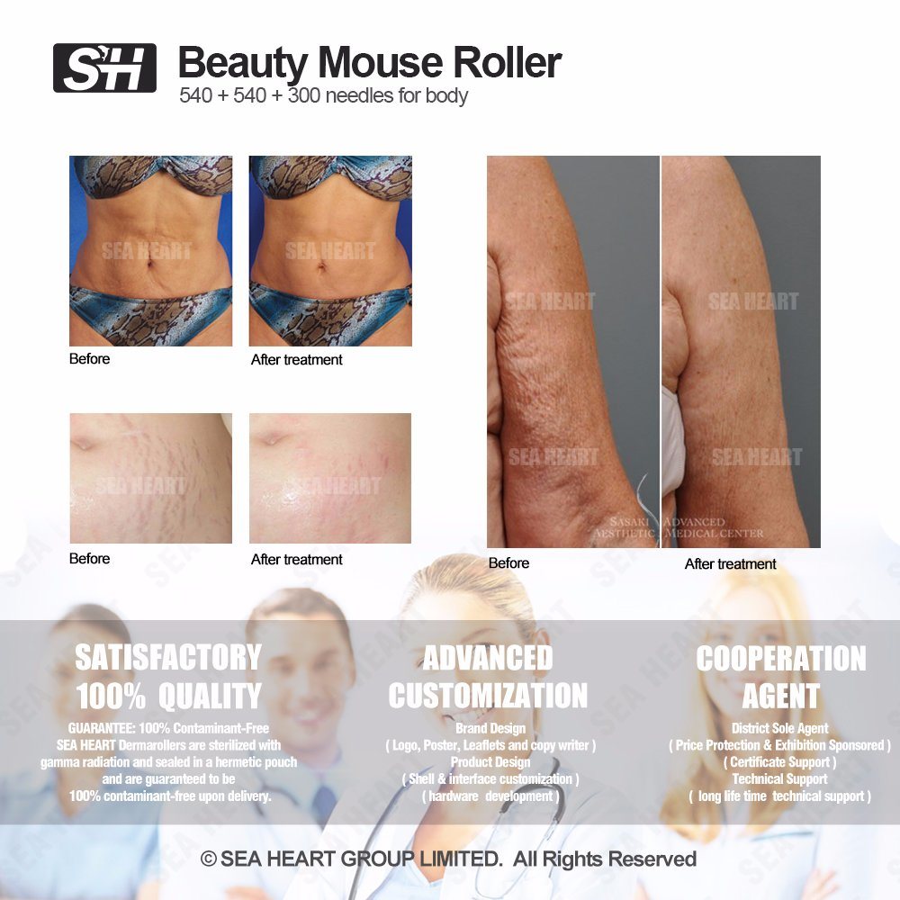 Beauty Mouse Dermaroller Home Use Skincare