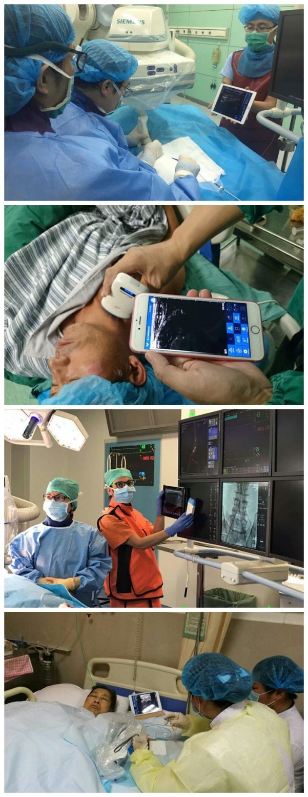 Mobile Phone Wireless Ultrasound Scanner