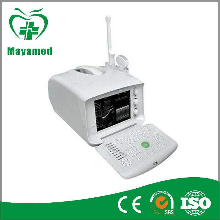 My-A001A Medical Equipment Portable B Ultrasound Scanner Price