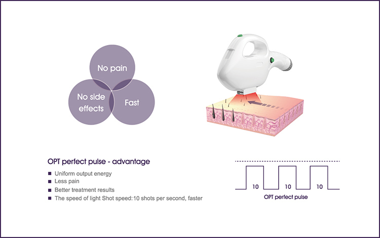 Globalipl Us601f Good Quality Hair Removal Machine with USA Radiator