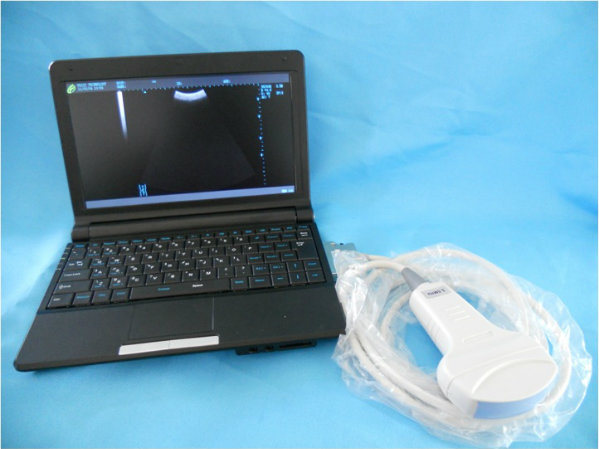 Portable Ultrasound System; Laptop Full Digital Ultrasound Scanner, PT3000d1