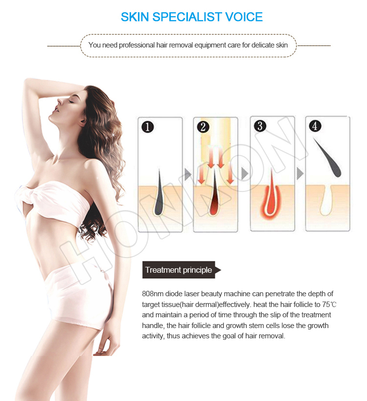 808nm Diode Laser Permanent Hair Removal Beauty Equipment