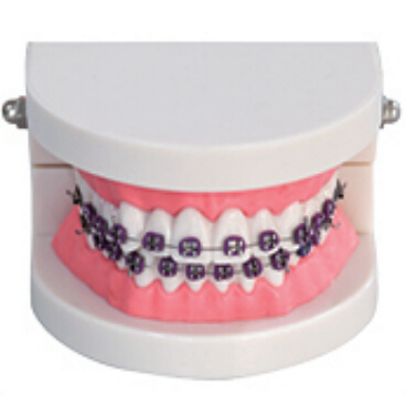 Wholesale Dental Orthodontic Demonstrator Model