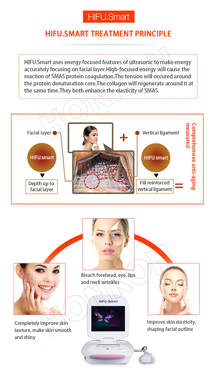 Hifu Skin Tighten Face Lift RF Wrinkle Removal Laser Machine