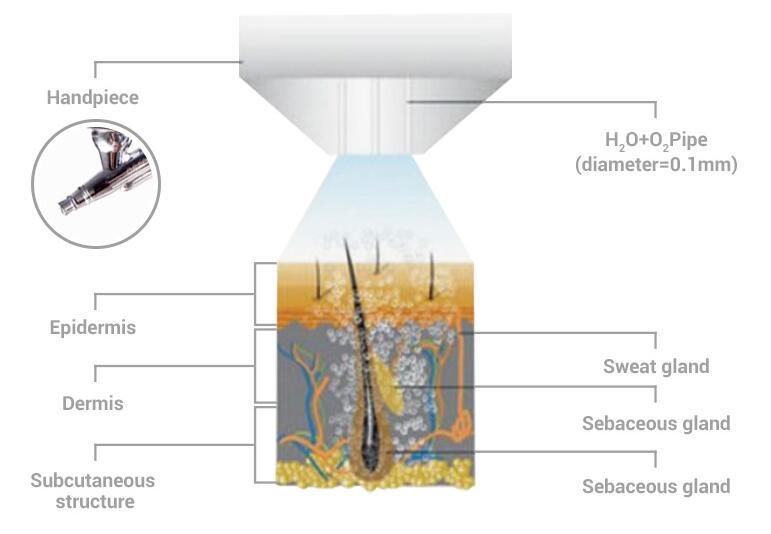 Dermabrasion Micro-Bubbles Dark Circles Oxygen Hydra Facial Beauty Equipment