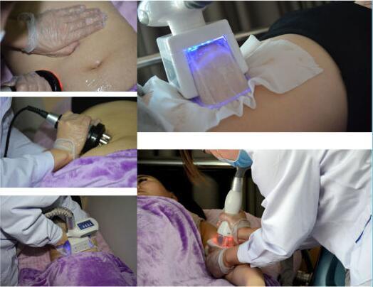 RF IPL Laser Beauty Medical Salon Equipment for Beauty Salon