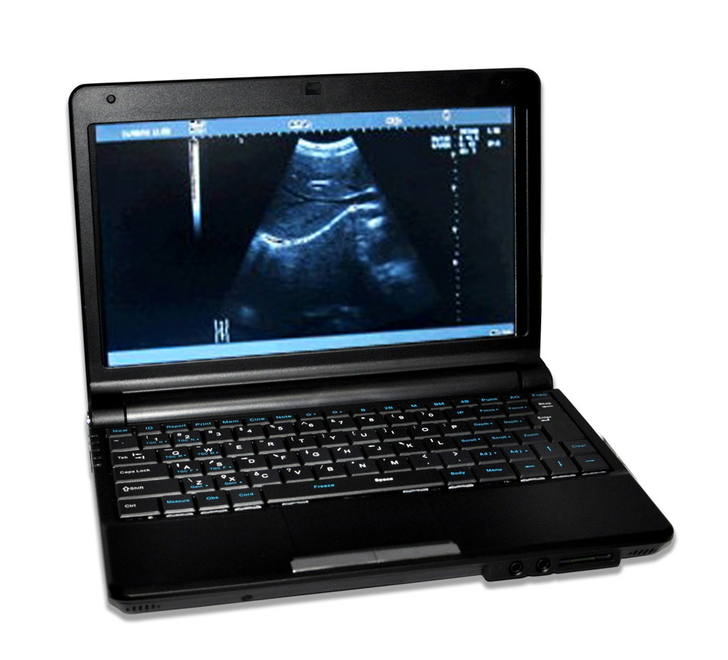 Factory Price 10 Inch Laptop Ultrasound Scanner with Linear Probe (RUS-9000F) -Fanny