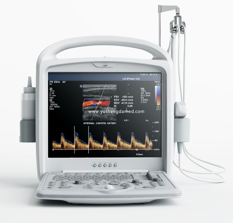 Cheapest 3D Color Doppler Medical Diagnostic Ultrasound