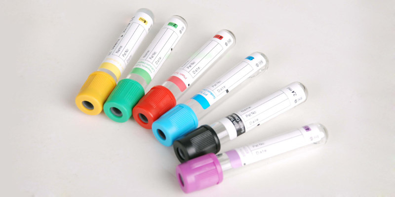 Disposable Vacuum Blood Collection Tube (PET, PP&Glass)