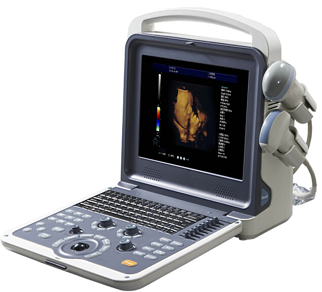 4D Portable Color Doppler Ultrasound Scanner (K6)