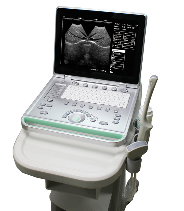 Hbw-7 B/W High Quality Laptop B Diagnostic Ultrasound Scanner