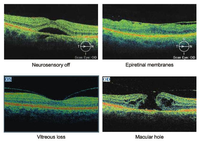 Ophthalmic Oct Equipment Optical Coherence Tomography Mce- Ose-2000