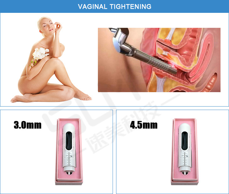 New Sex Vaginal Tightening Technology Female Privacy Protection Hifu Vaginal Tighten Machine