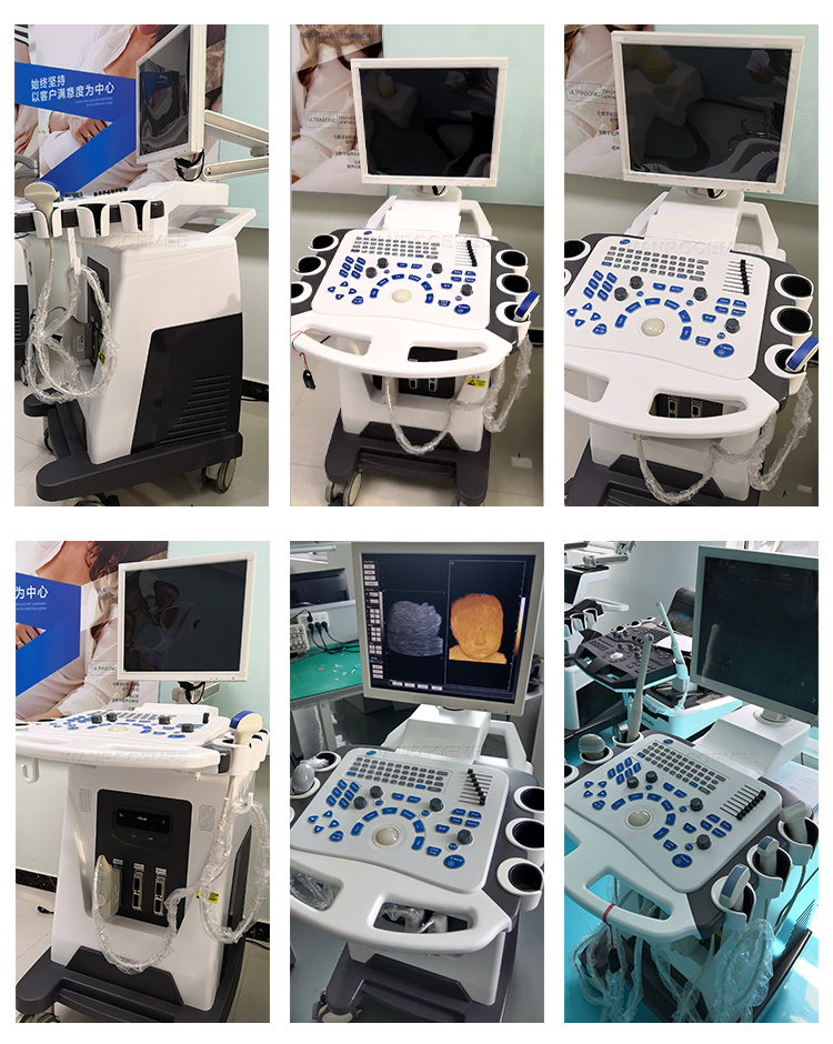 Usc80 Medical Equipment 4D Color Doppler Portable Obstetric Ultrasound Scanner Machine