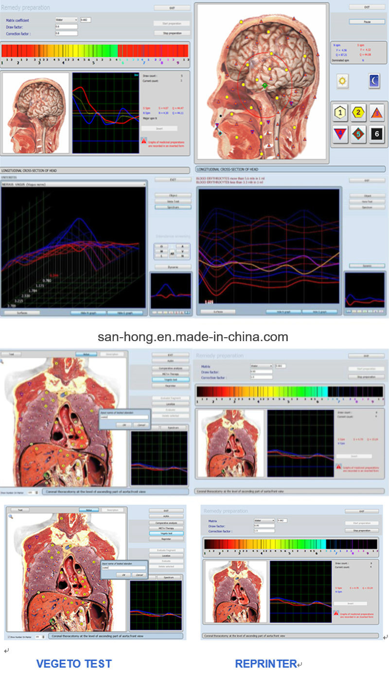 Professional in OEM ODM Service 9d Nls Full Body Health Analyzer Diagnostic Tester 3D Nls Health Analyzer