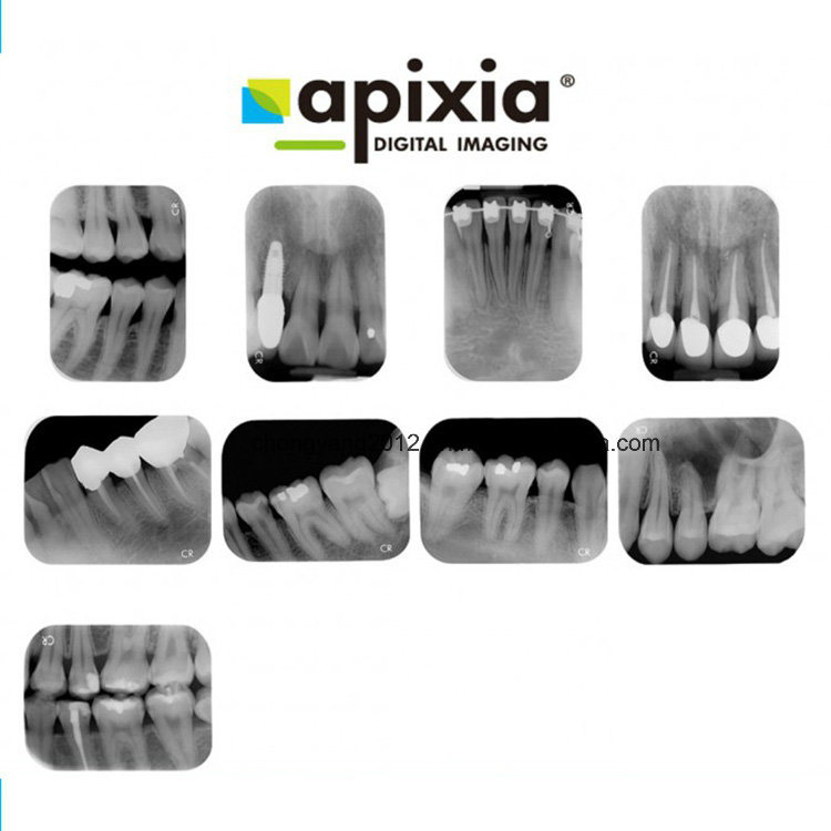 Apixia Digital Dental X-ray PSP Scanner