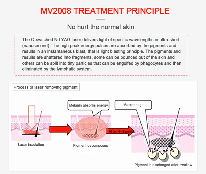 Portable Beauty Machine Q-Switched 1064nm 532nm Laser Machine