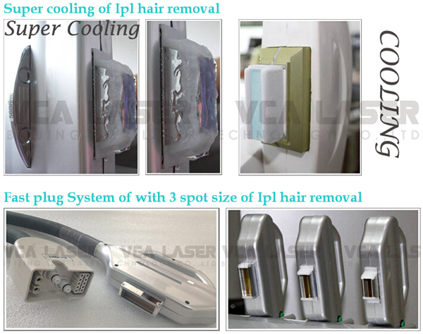 Best Home Elight RF IPL Fast Salon Opt Shr Blood Vessel Equipment Laser Hair Removal