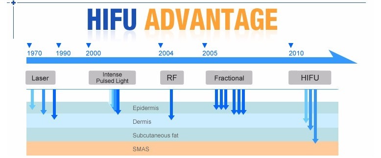 Best Anti-Aging High Intensity Focused Ultrasound Hifu Wrinkle Removal