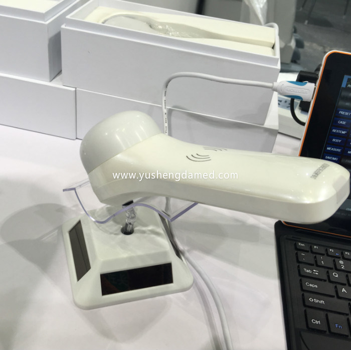 Ce FDA New Developed 4D Wireless Ultrasound Machine Bladder Probe