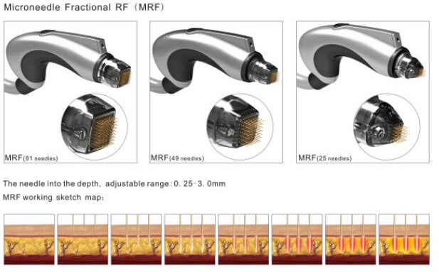 Fractional RF Facial Cleanser /Body Skin Care Beauty Machine (MR18-2S)