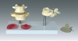 Xy-3393-13 Vertebrae Representation Model with Plastic Base