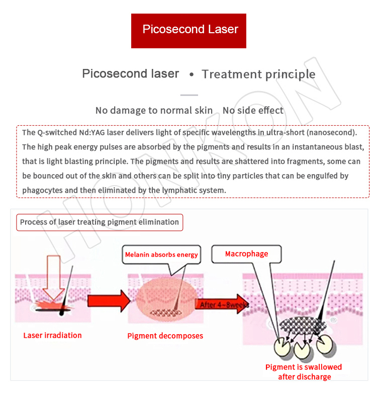 Professional Picosecond 1064nm Laser Melasma Pigmentation Tattoo Removal Beauty Machine