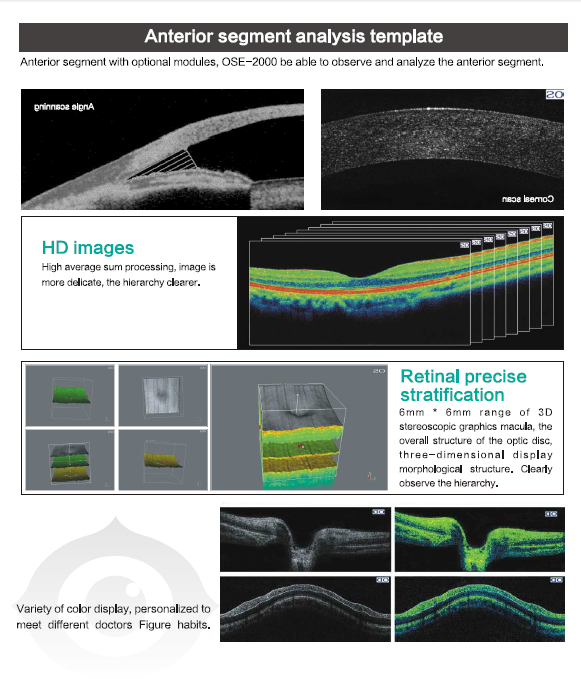 Ose-2000 Ophthalmic Oct, Optical Coherence Tomography, Ophthalmic Equipment