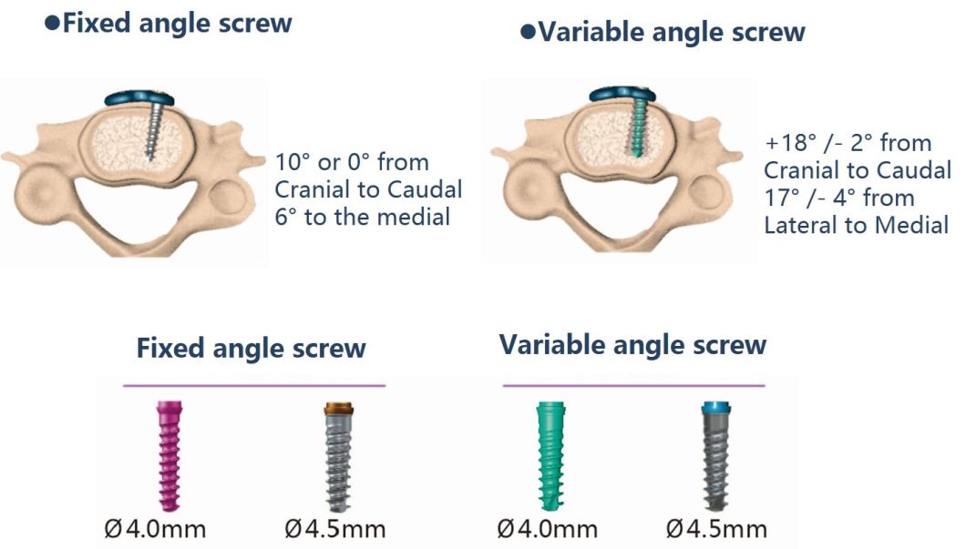 Self-Tapping Variable-Angle Screw of Spine Fixation System