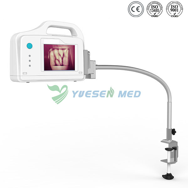 Ysvv200 Hospital High Quality IV Vein Finder Vein Viewer Price