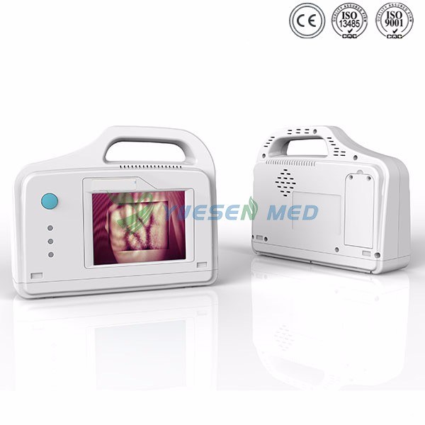 Ysvv200 Hospital High Quality IV Vein Finder Vein Viewer Price