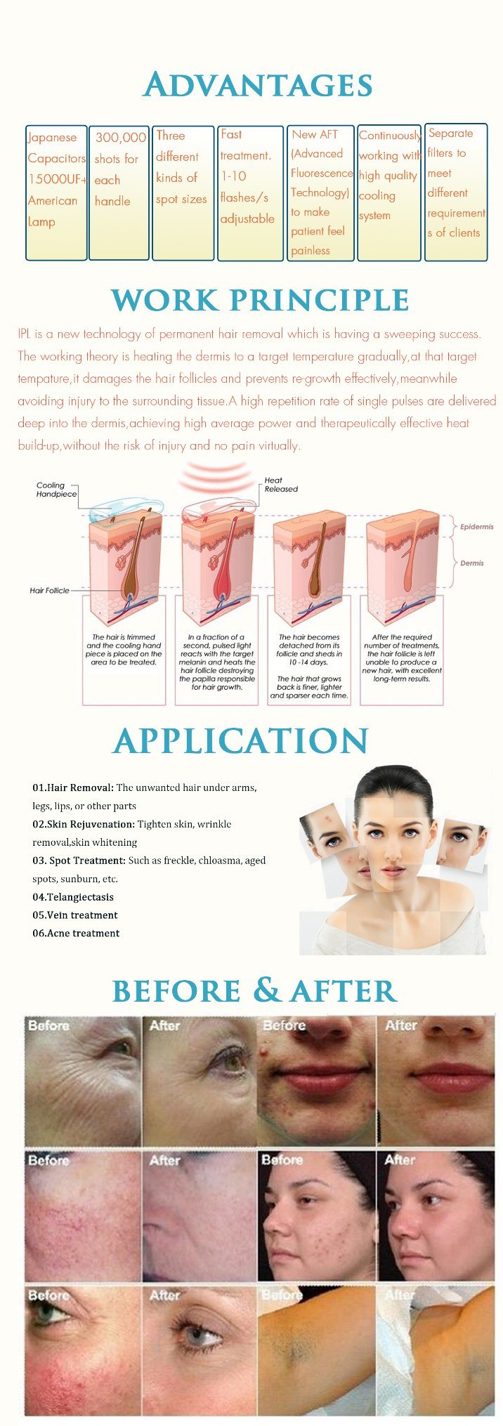 Portable IPL Shr Opt Machine for Permanent Hair Removal