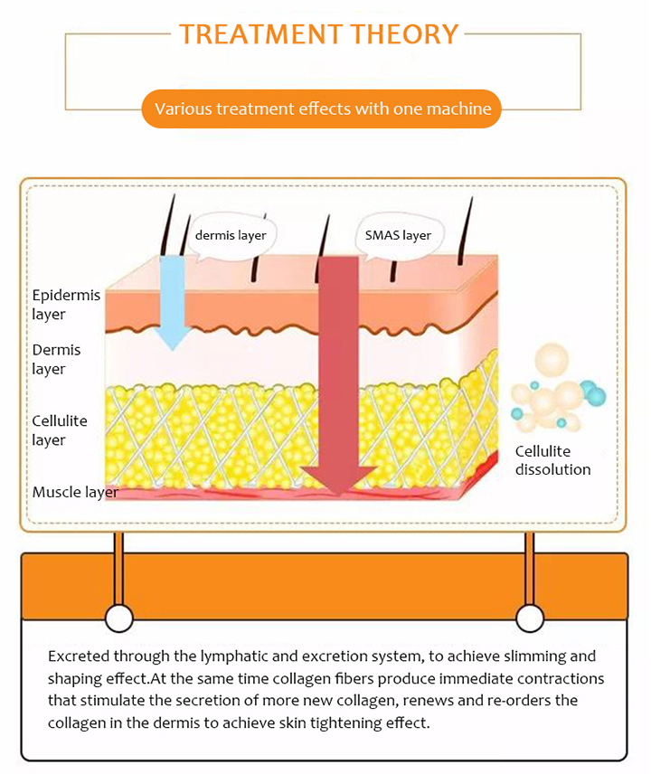 Skin Tightening Scar Removal Expert Medical Machine for Kidney and Stomach