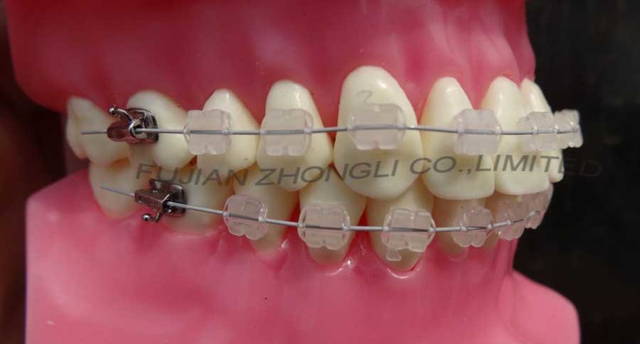 High Quality Orthodontic Demonstrator Model