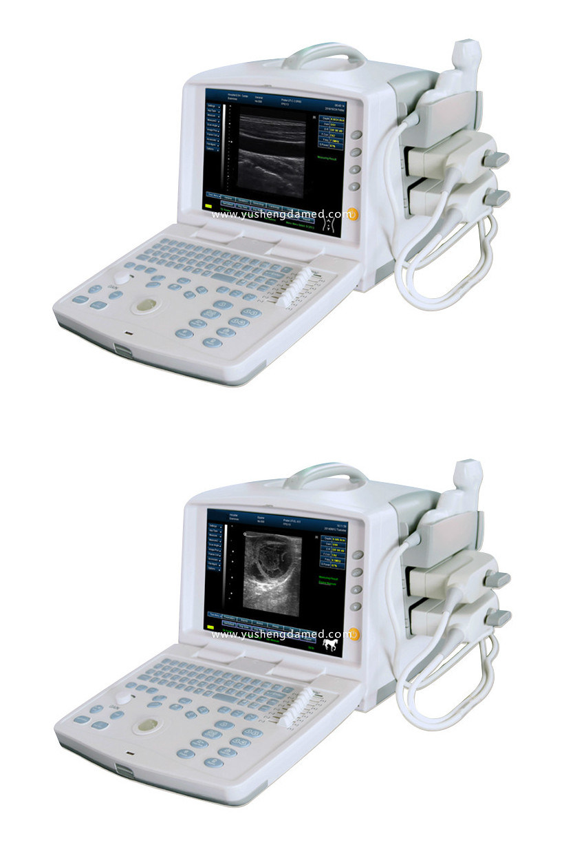 Ce Approved PC Based Medical System Digital Portable Ultrasound Scanner