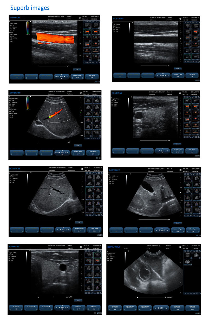 Good Price for Portable Color Doppler Ultrasound Machine, Es240, Ultrasound Portable Fetal Color Doppler