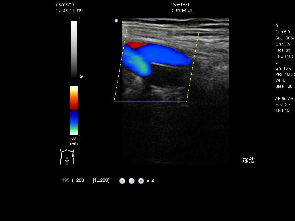 Medical Used Real Time 3D Digital Color Ultrasound Scanner