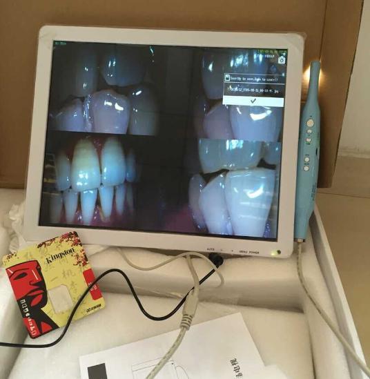 Wireless Dental Intra Oral Camera USB+VGA+Video Osa-9503ow