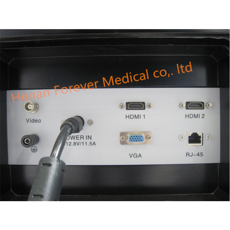 Ce Approved Trolley 4D Color Doppler Ultrasound Scanner for Gynecology